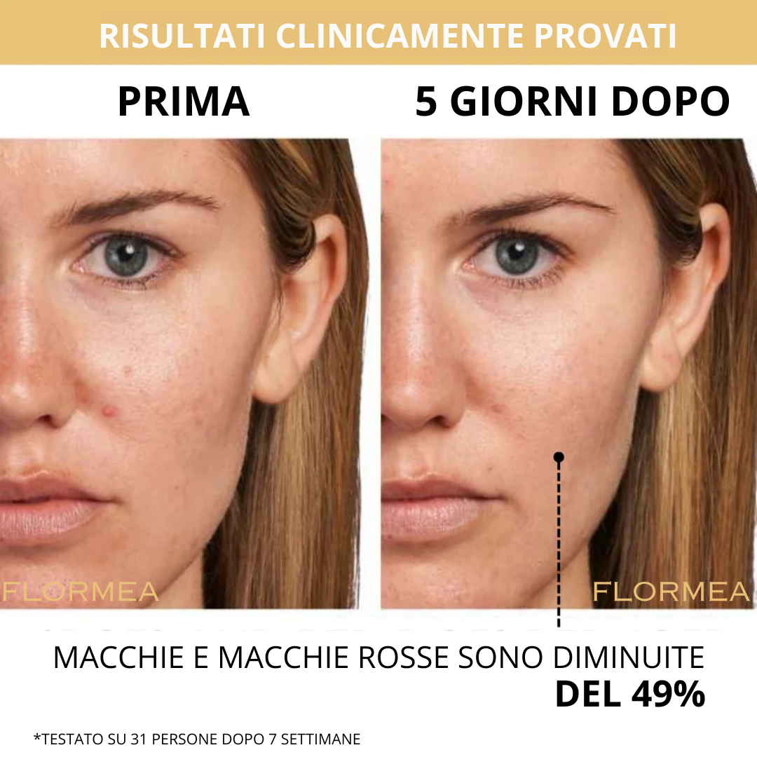FLORMEA CON CAPSULE DI VITAMINA C